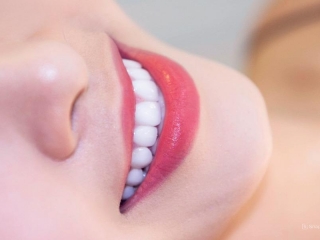So sánh 3 loại mão răng phổ biến: Sứ kim loại, toàn sứ và sứ cao cấp – Nên chọn loại nào?