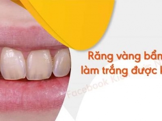 LÀM TRẮNG RĂNG