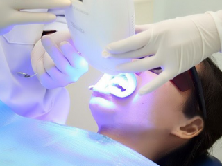 Tẩy trắng răng an toàn - Lấy lại nụ cười trắng sáng chỉ sau 60 phút