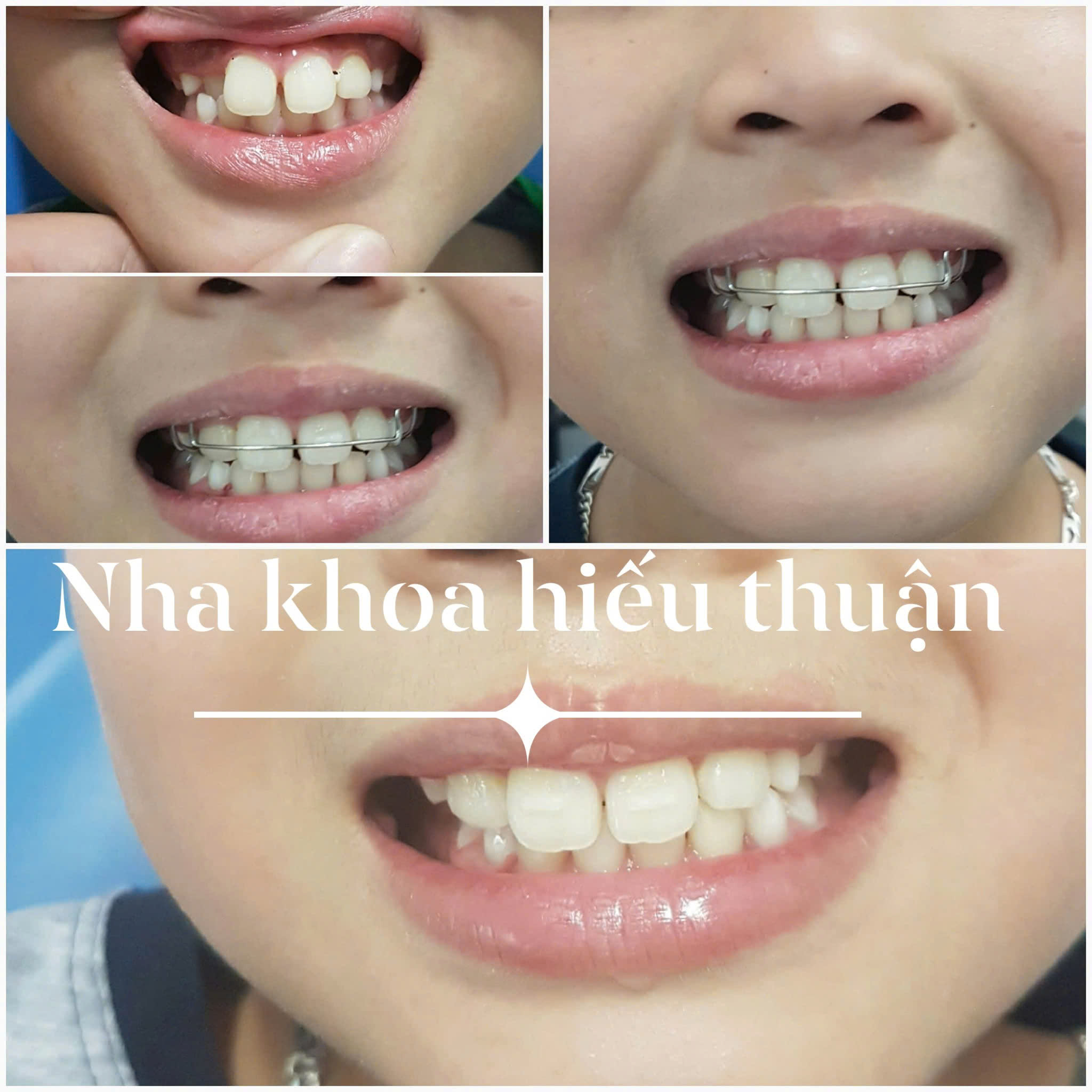 Nha khoa