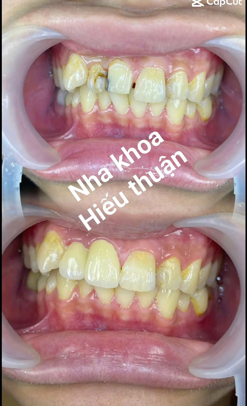Nha khoa