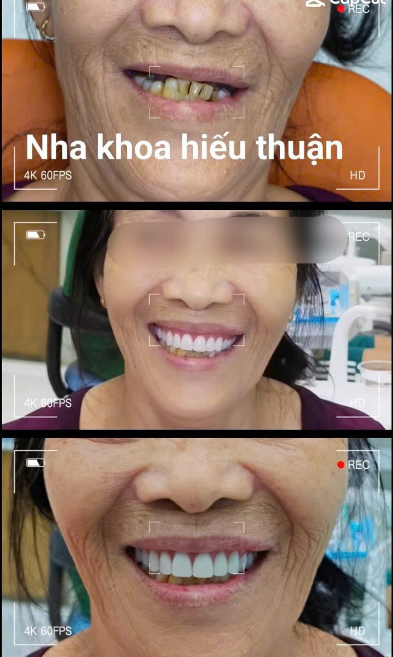 Nha khoa